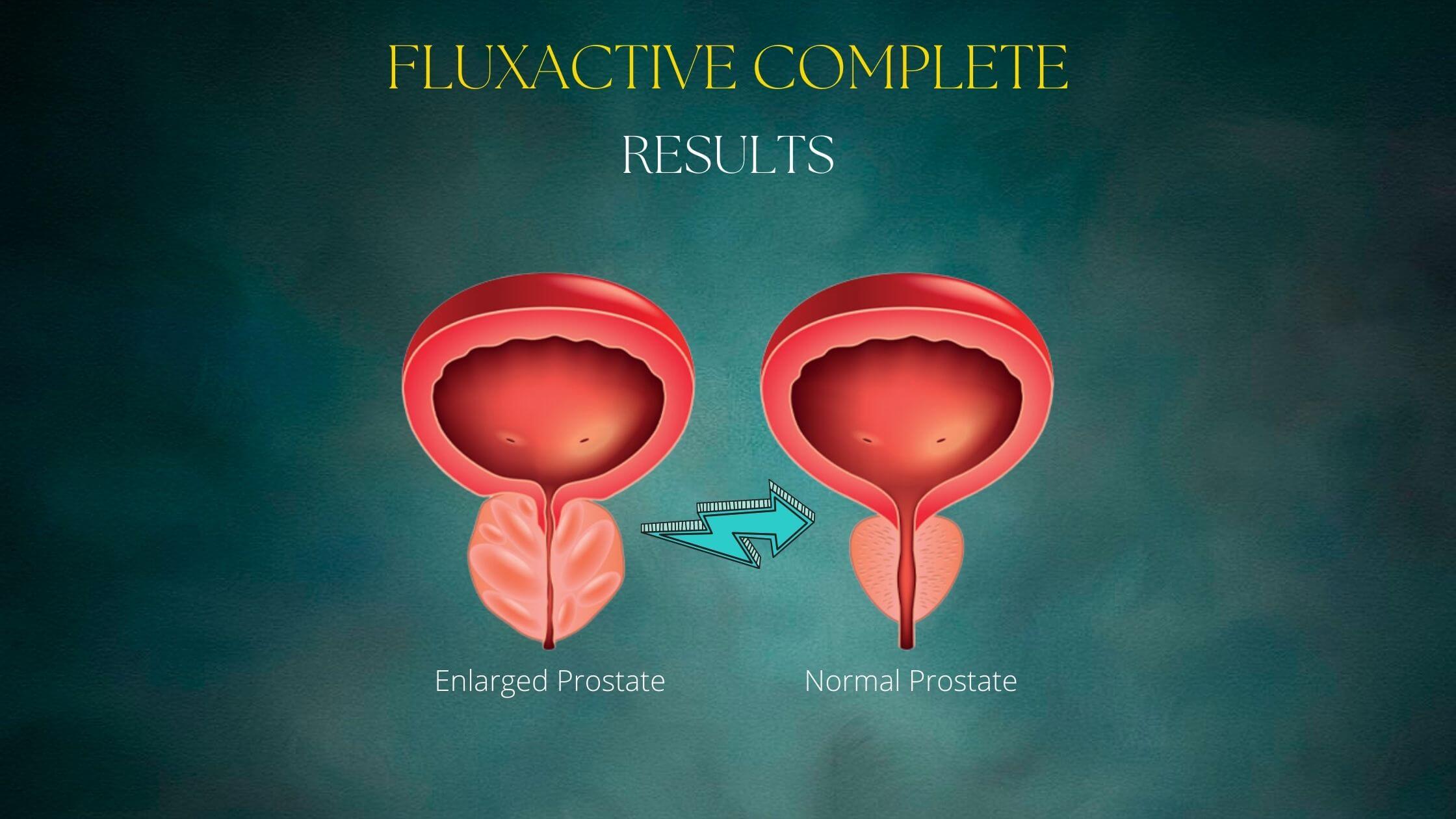 Fluxactive Complete Results