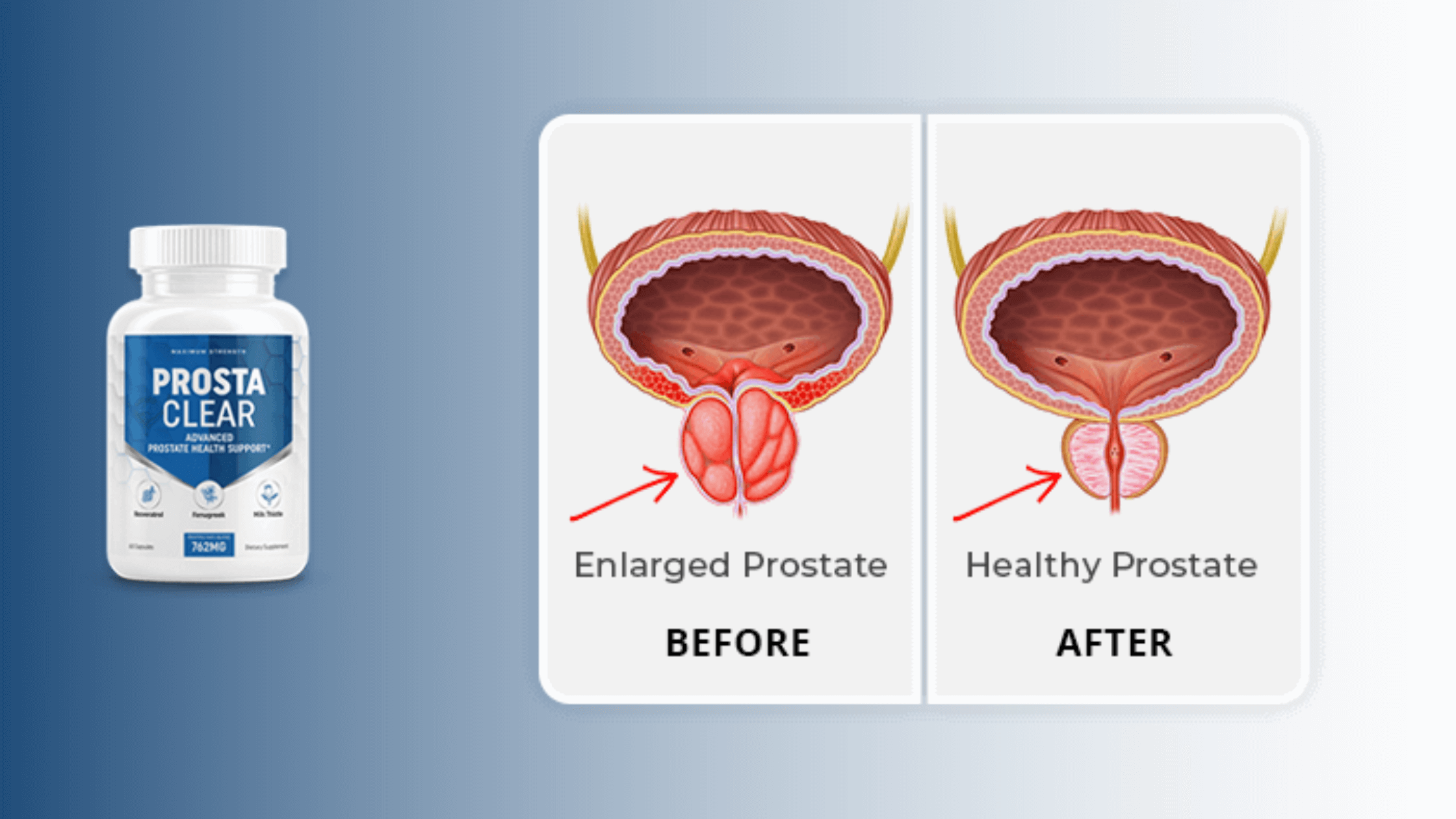 ProstaClear Results