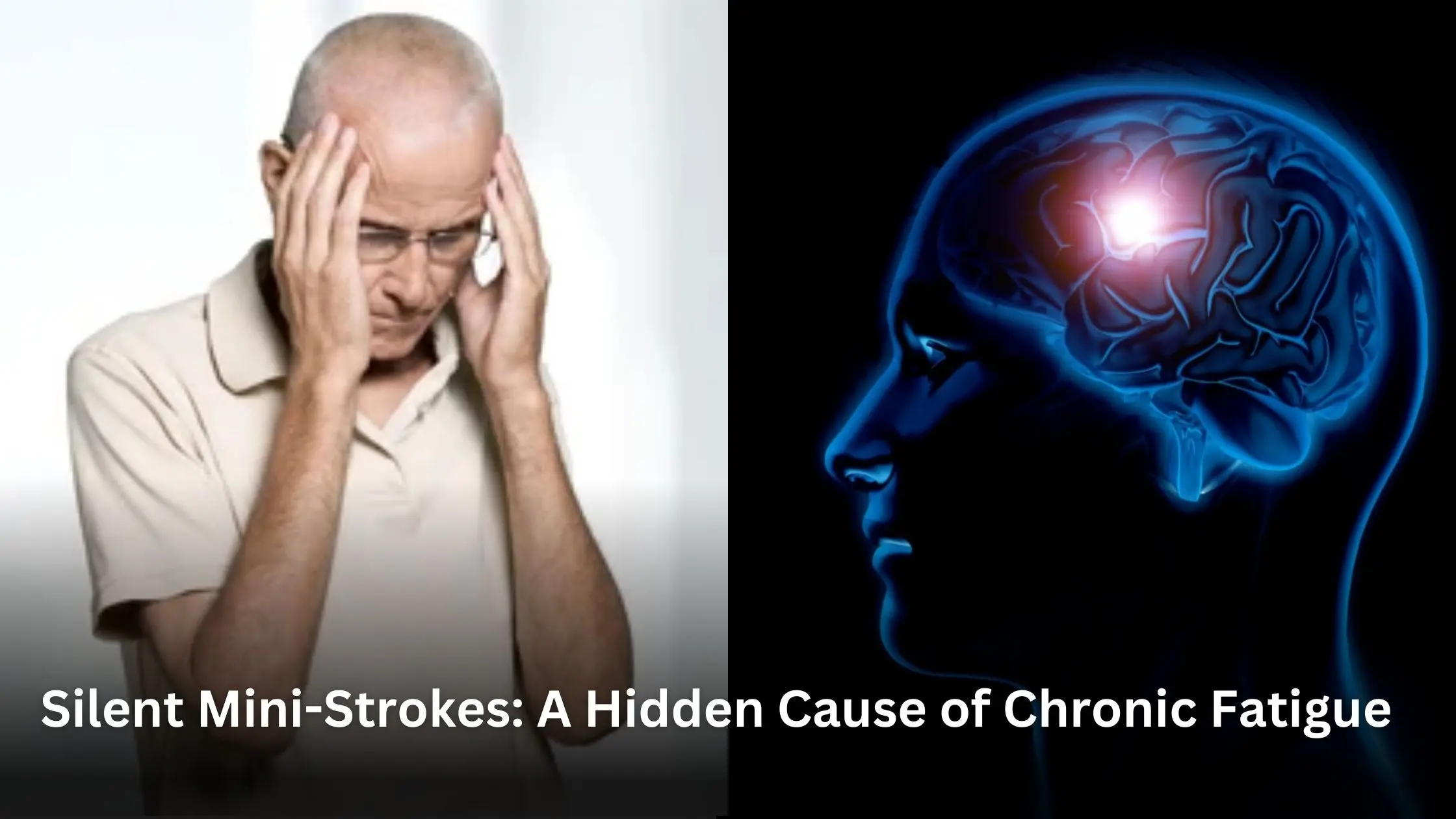 Silent Mini-Strokes: A Hidden Cause of Chronic Fatigue